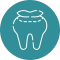 Dental Filling